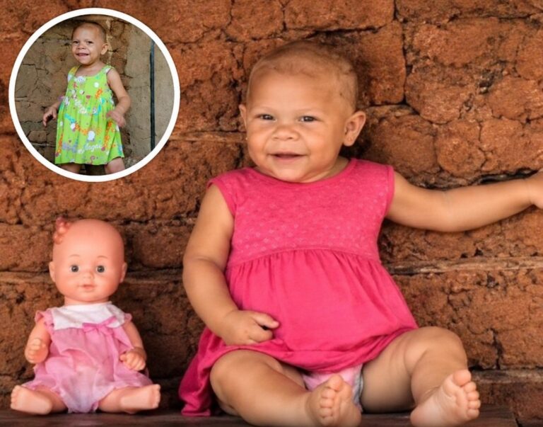 A mulher que viveu 41 anos presa no corpo de um bebé devido a um erro médico imperdoável!